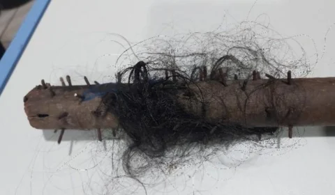 Vigia é agredido na cabeça com pedaço de madeira com pregos em Porto Velho