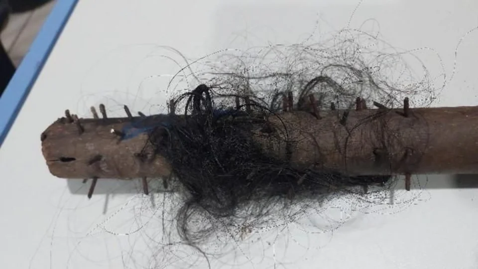 Vigia é agredido na cabeça com pedaço de madeira com pregos em Porto Velho