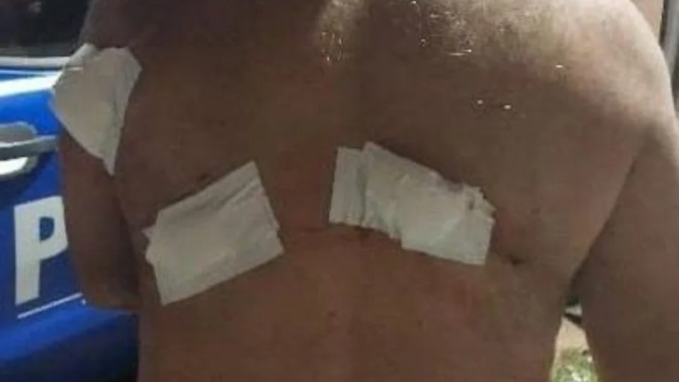 Homem é esfaqueado ao tentar ajudar cadeirante em Porto Velho