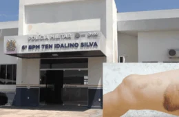 Criança é brutalmente espancada pelo pai alcoolizado no interior do Acre