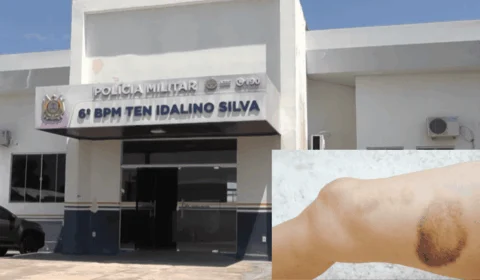 Criança é brutalmente espancada pelo pai alcoolizado no interior do Acre