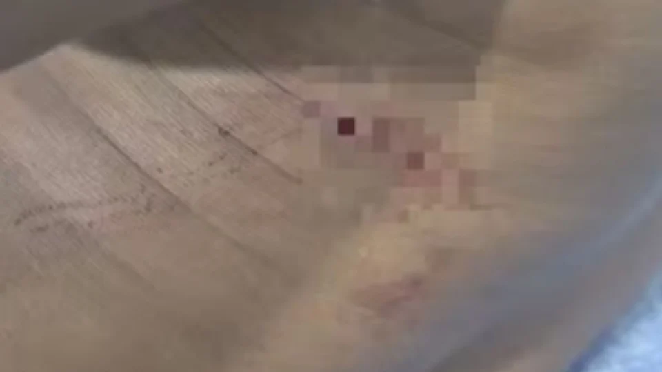 Ex-companheira é suspeita de esfaquear homem em área rural de Amajari