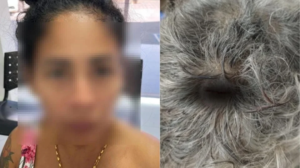 Idosa de 84 anos é atacada pela neta com tesoura e cabo de vassoura