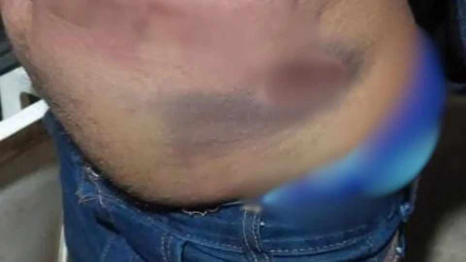 Homem sofre agressões e tem móveis destruídos por familiares no Jardim Santana em Porto Velho