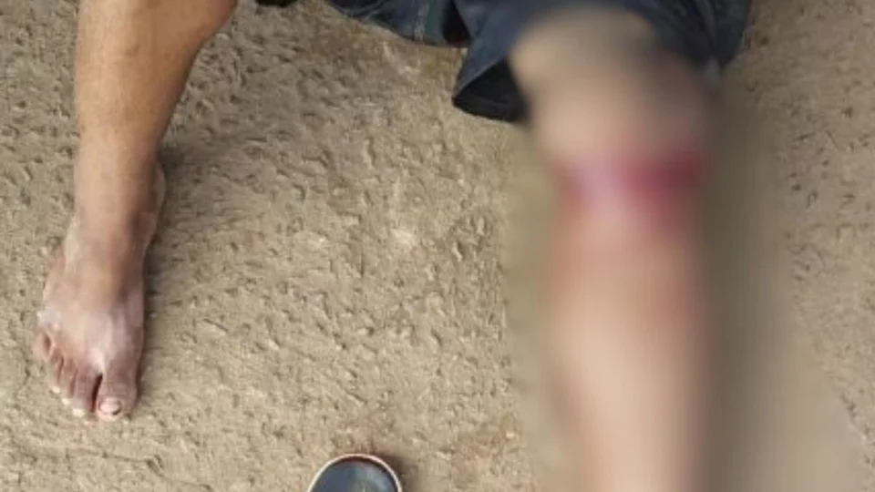 Homem é gravemente ferido com golpes de facão na zona Leste de Porto Velho