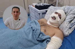 Ex-prefeito de Borba sofre queimaduras após explosão de lancha