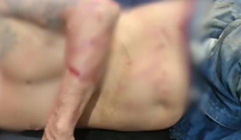 Homem é atacado por pitbull ao invadir residência e acaba preso em Porto Velho