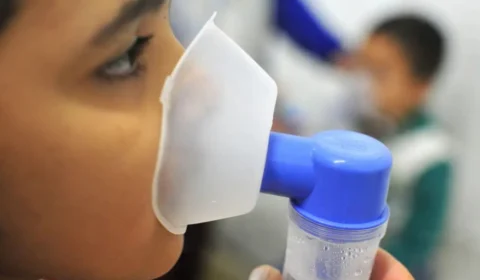 Acre registra aumento de casos de Síndrome Respiratória Grave impulsionado pela influenza A